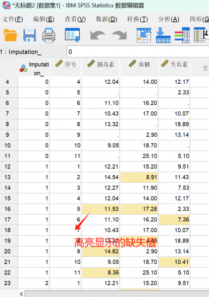 多重插补替换缺失值