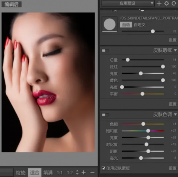 SkinFiner