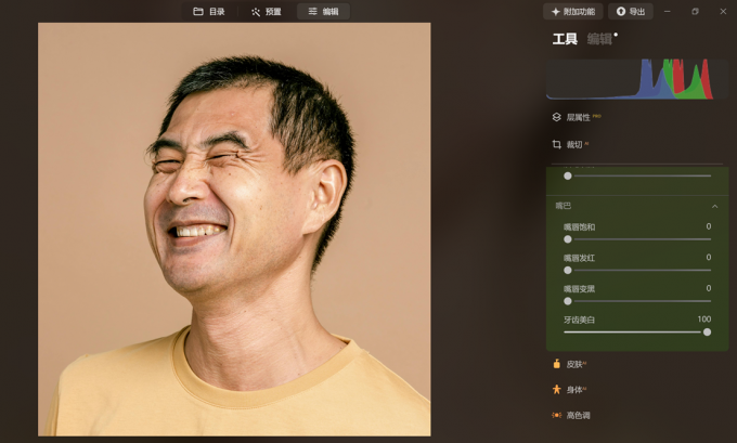 提高牙齿美白数值