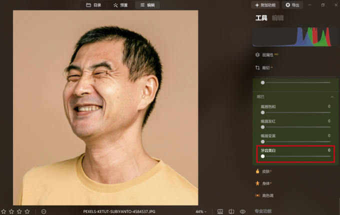 牙齿美白选项