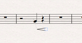 渐强符号添加界面