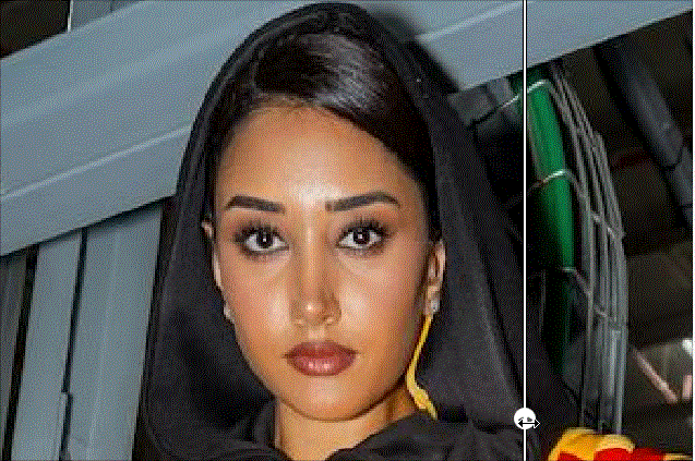 瘦脸前后效果对比