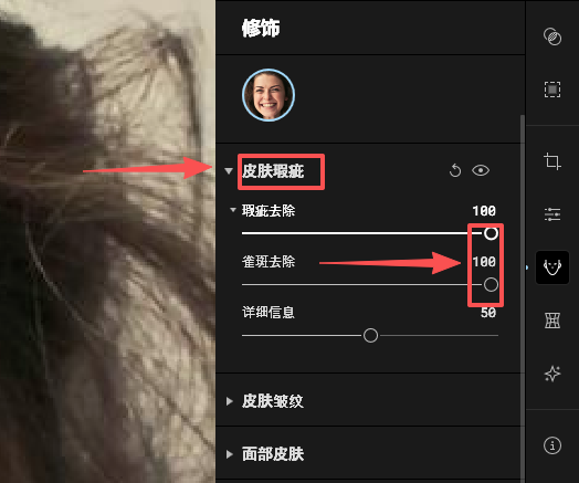 设置去除皮肤瑕疵参数